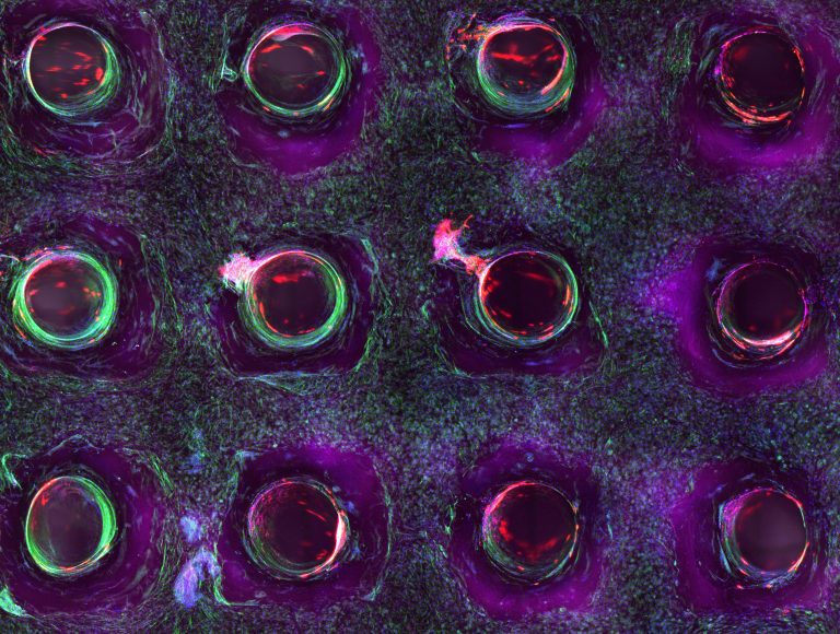 3D bioprinting vasculature
